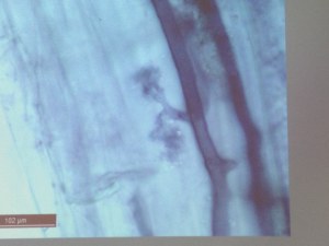Arbuscule of phosphorus root deposit of Glomus sp. of fungi from a restoration site